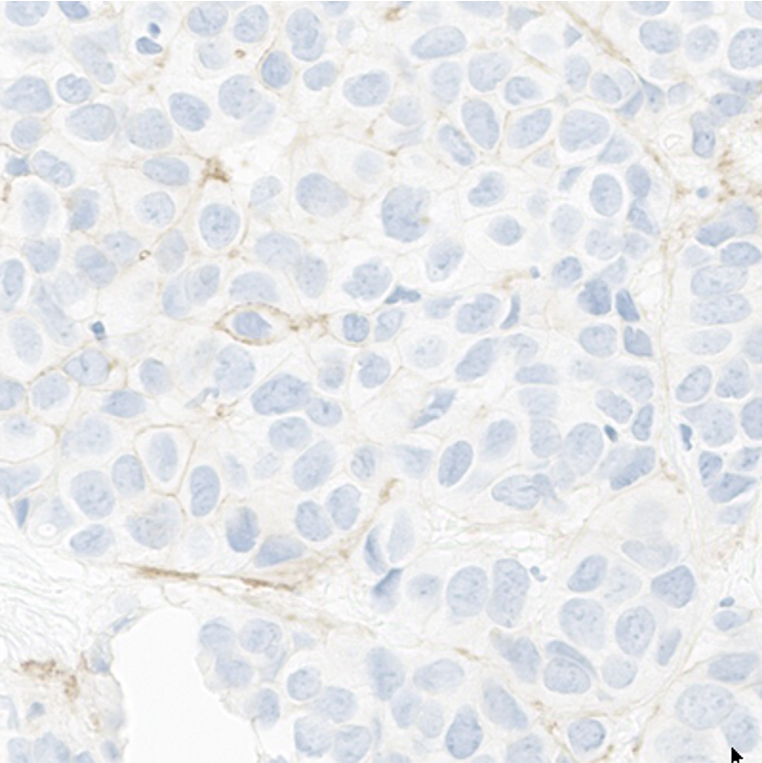 015 AVD-16AOZ-4730A 4B5 Ab