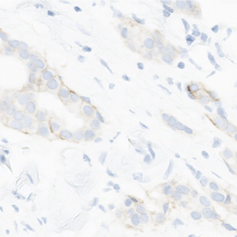 024 AVD-16AOZ-4198A 4B5 Ab